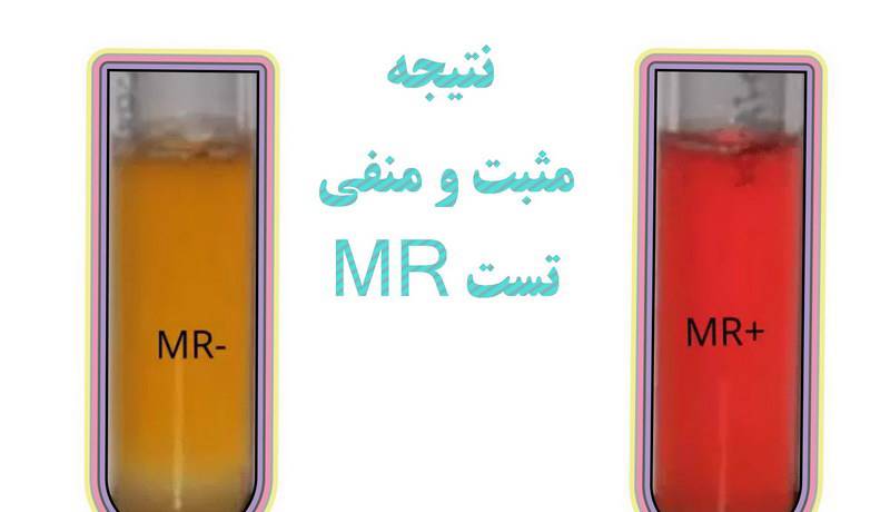 معرف vp