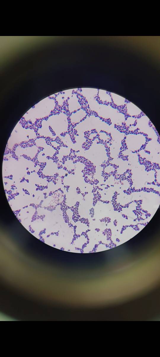 کیت رنگ‌آمیزی گرم (Gram Staining Kit)