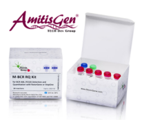 کیت مولکولی BCR-ABL (p210) Detection & Quantitation Kit