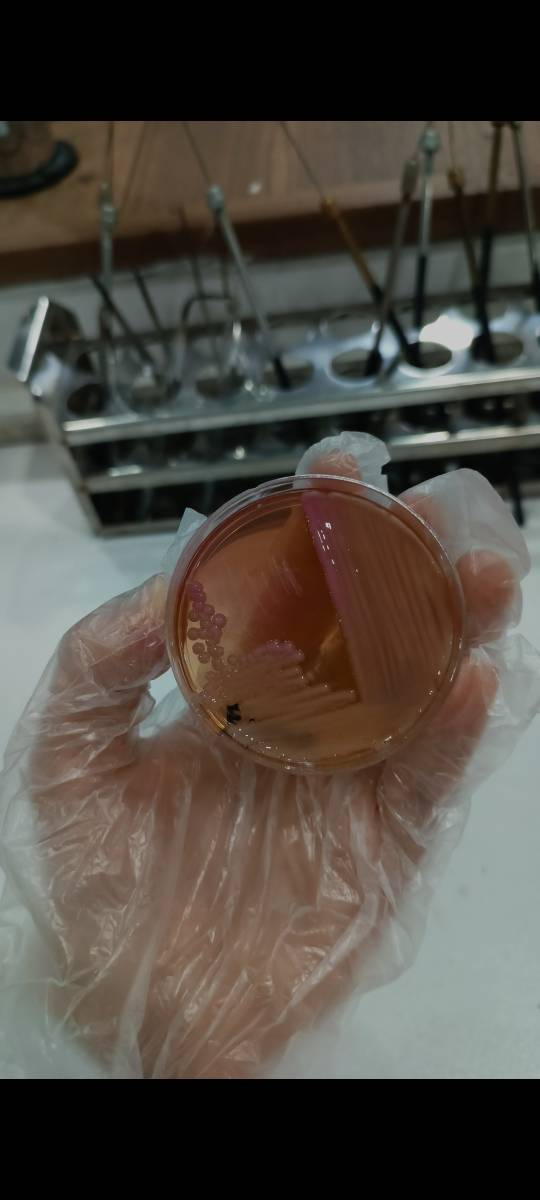 محیط کشت EMB (Eosin Methylene Blue Agar)