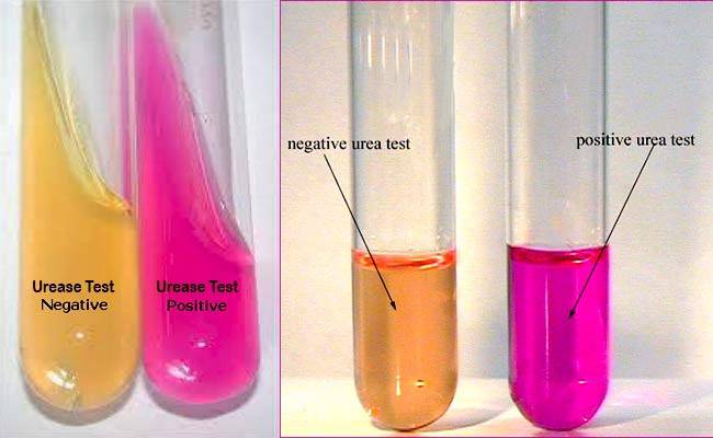 Urea Agar Base 