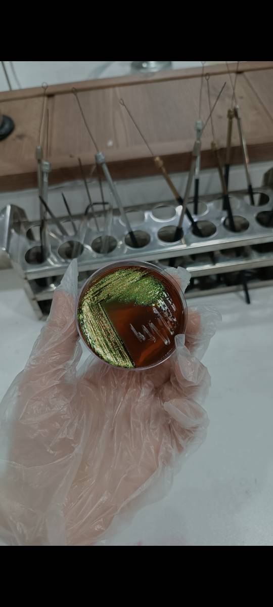 محیط کشت EMB (Eosin Methylene Blue Agar)