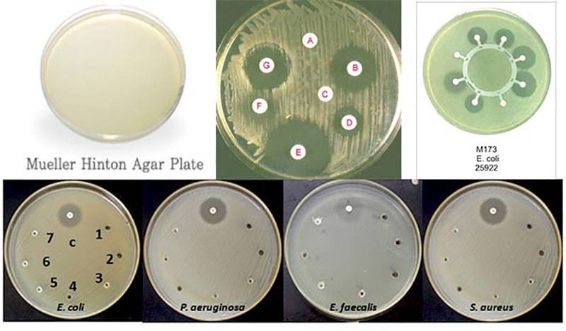 مولر هینتون آگار (Mueller-Hinton agar) 