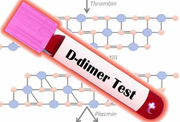 کیت d. dimer 