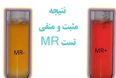 معرف vp