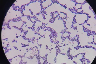 کیت رنگ‌آمیزی گرم (Gram Staining Kit)