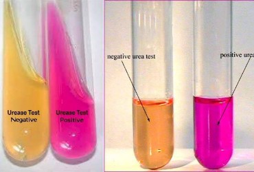 Urea Agar Base 