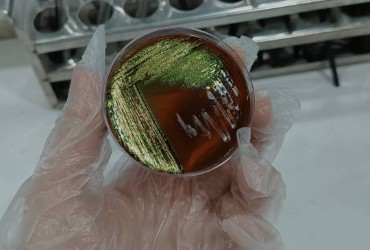 محیط کشت EMB (Eosin Methylene Blue Agar)