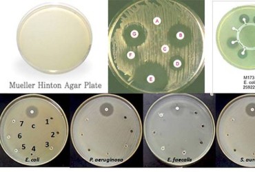 مولر هینتون آگار (Mueller-Hinton agar) 